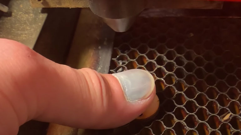 Αφαίρεση αιματώματος κάτω από το νύχι 