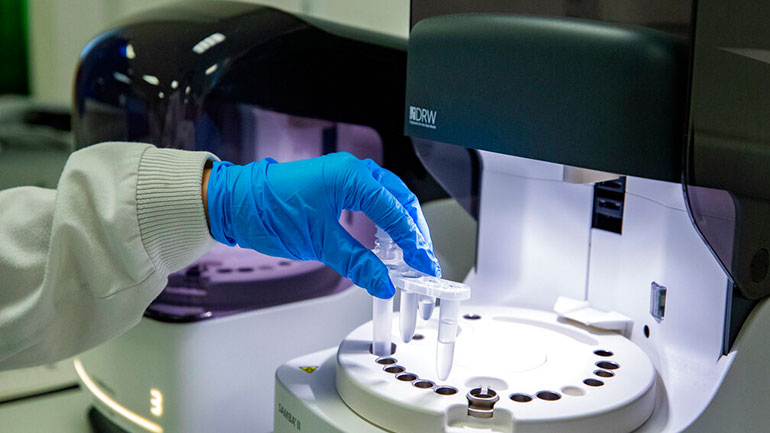 Σλοβακία: Στα 3.042 τα νέα κρούσματα από τον COVID-19