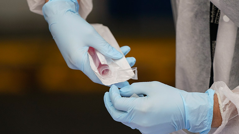 Covid-19: Ξεκίνησε η κλινική δοκιμή του εμβολίου BriLife σε ανθρώπους στο Ισραήλ