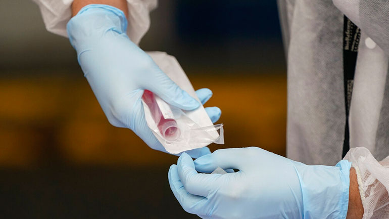 Τσεχία: Ακόμα 9.241 κρούσματα και 225 θάνατοι λόγω COVID-19