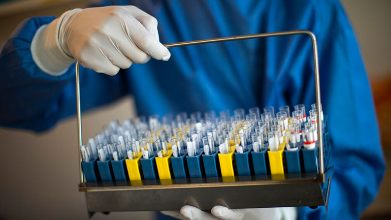 Έρευνα: Νορβηγοί επιστήμονες συλλέγουν σπέρμα από ασθενείς με Covid-19 για να βρουν πιθανές επιπτώσεις στους απογόνους