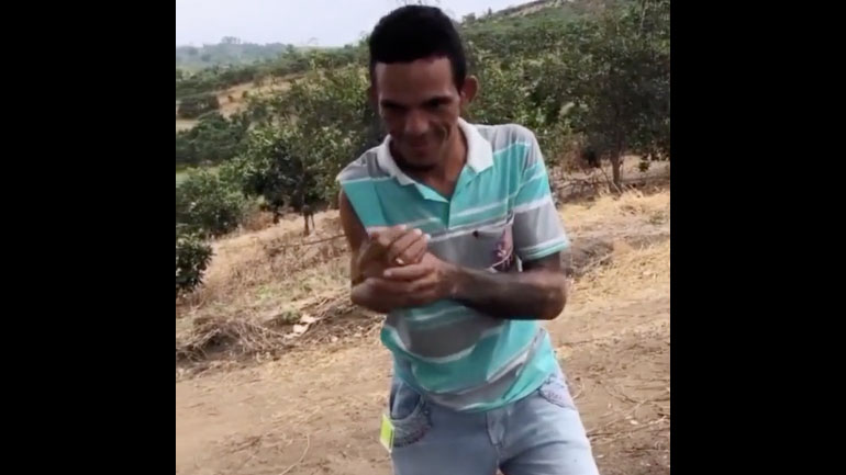 Ένας άντρας γυρίζει το σπασμένο χέρι του