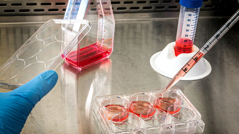 Νέα κριτήρια για την υποβολή σε τεστ κορωνοϊού στη Γερμανία λόγω υπερφόρτωσης των εργαστηρίων