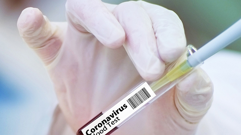 Covid-19: To υποψήφιο εμβόλιο της Curevac μπορεί να διατηρηθεί για μήνες στο ψυγείο