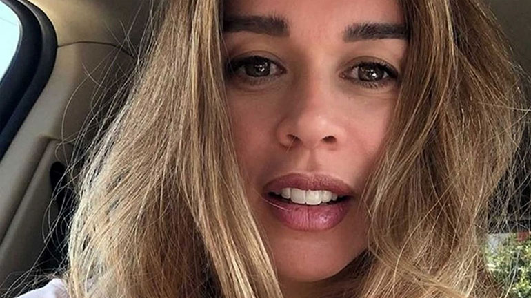 Η Έρρικα Πρεζεράκου μας δείχνει το χέρι της μετά το ατύχημα που οδήγησε σε ακρωτηριασμό του δαχτύλου της