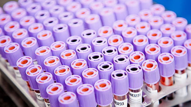 Έρευνα: Μειωμένος ο κίνδυνος για όσους έχουν ομάδα αίματος Ο ή αρνητική να κολλήσουν κορωνοϊό