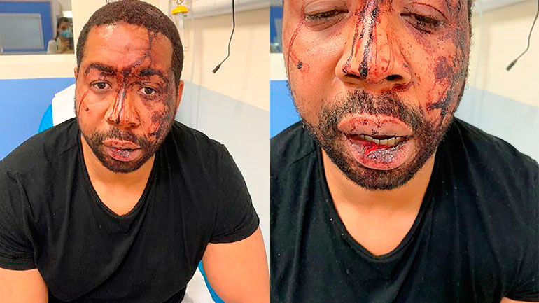 Γαλλία: Σε διαθεσιμότητα αστυνομικοί μετά από επίθεση εναντίον μαύρου μουσικού