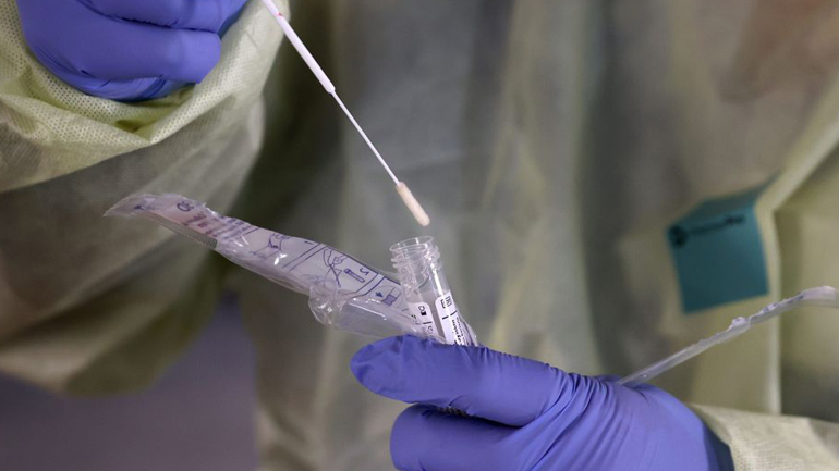 Πότε το μοριακό τεστ για κορωνοϊό είναι πιθανότερο να βγει ψευδώς αρνητικό