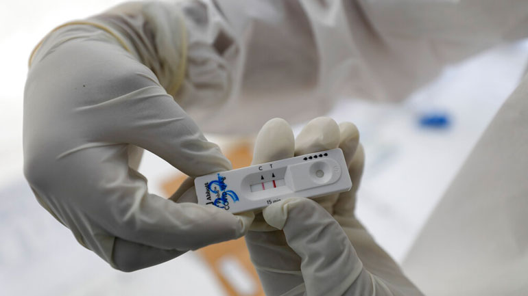 «Ο κορωνοϊός μπορεί να προκαλέσει γήρανση»