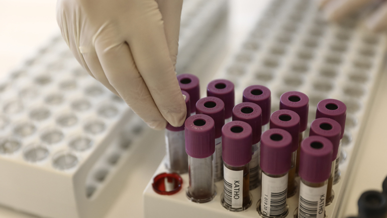 Έρευνα: 5 γονίδια στο DNA αυξάνουν τον κίνδυνο σοβαρής Covid-19