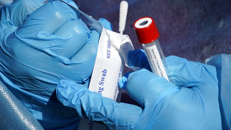 «Τα πολλά αυτοαντισώματα σε ασθενείς με κορωνοϊό σχετίζονται τόσο με τη σοβαρή όσο και με τη μακρά Covid-19»