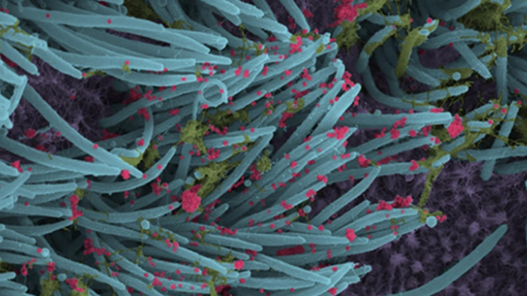 Εικόνες του SARS-CoV-2 να προσβάλλει τα κύτταρα του αναπνευστικού