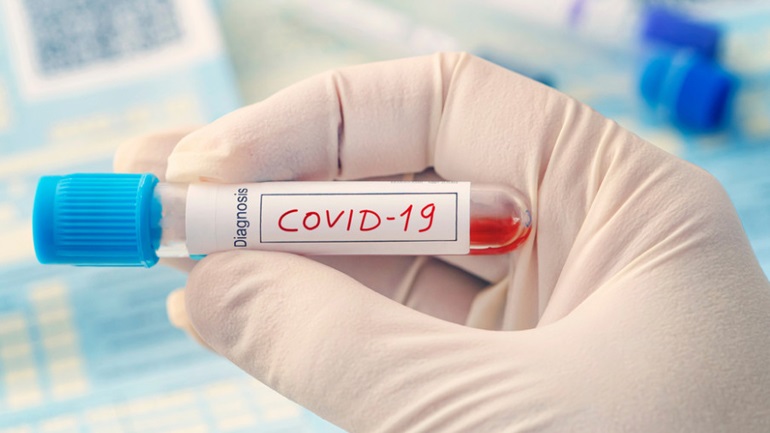 Μόνο με αρνητικό τεστ Covid-19 η είσοδος στην Τουρκία για τους ταξιδιώτες