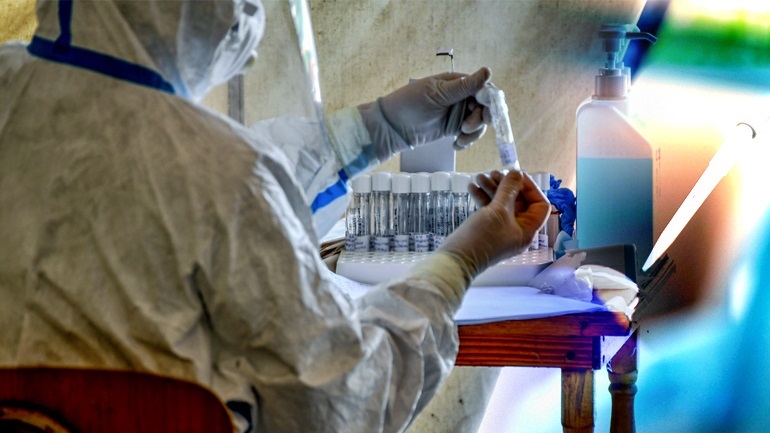 Ιταλία: Γιατί το ΣτΕ είπε «ναι» στην ευρεία χορήγηση υδροξυχλωροκίνης σε ασθενείς με Covid-19 Ιταλία: Γιατί το ΣτΕ είπε «ναι» στην ευρεία χορήγηση υδροξυχλωροκίνης σε ασθενείς με Covid-19