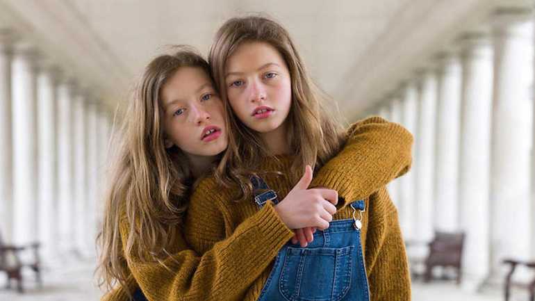 Νέα έρευνα: Μερικοί πανομοιότυποι δίδυμοι δεν έχουν πανομοιότυπο DNA