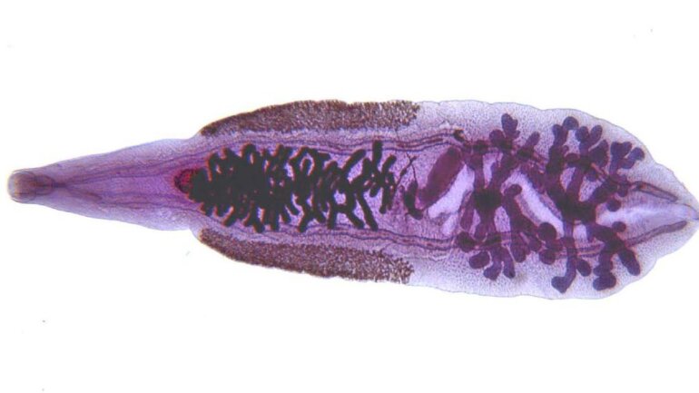 Έχασε το μισό συκώτι επειδή κατανάλωσε ωμά ψάρια με παράσιτα