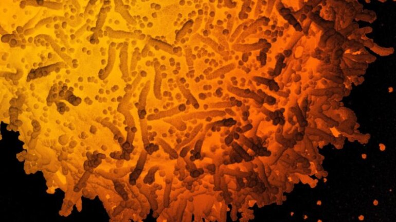 Γιατί η μετάλλαξη E484K ανησυχεί τους επιστήμονες