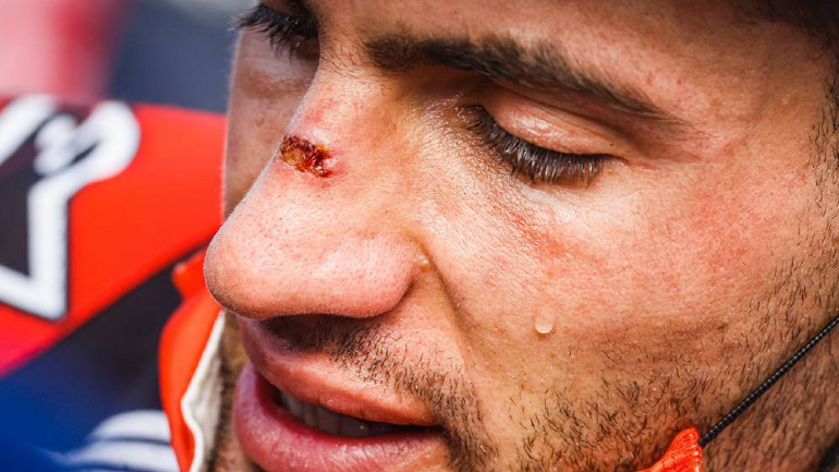 Εσύ πόσο… Homo Extremius είσαι;