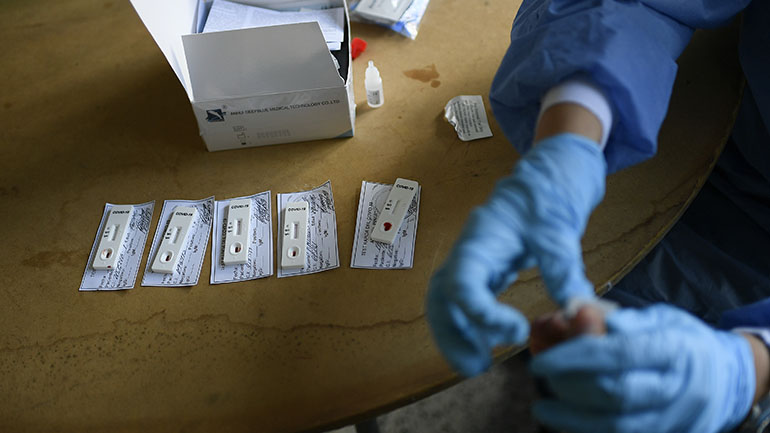 Στη δεύτερη θέση στην Ευρώπη για τη διενέργεια εργαστηριακών ελέγχων Covid-19 στον πληθυσμό η Κύπρος Στη δεύτερη θέση στην Ευρώπη για τη διενέργεια εργαστηριακών ελέγχων Covid-19 στον πληθυσμό η Κύπρος