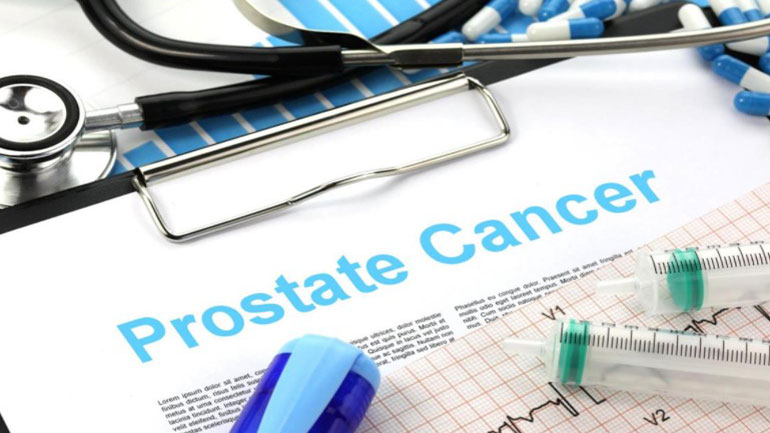 Άνδρες με τοπικό καρκίνο του προστάτη παρουσιάζουν μειωμένη ποιότητα ζωής μακροπρόθεσμα