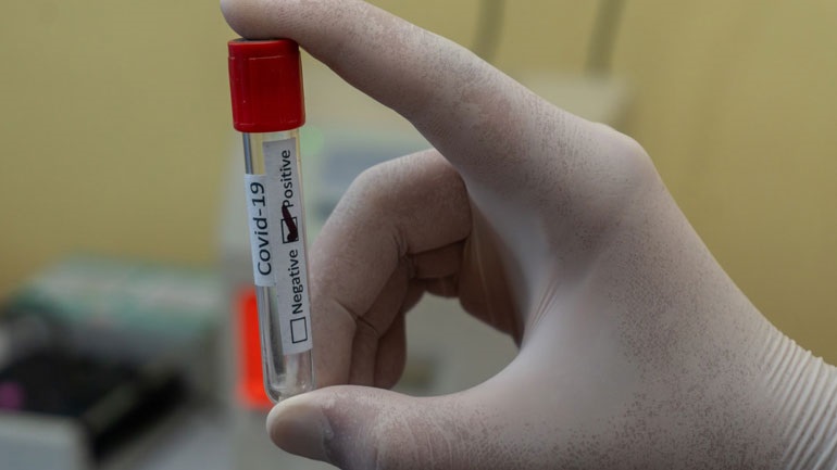 Τρεις κινεζικές εταιρείες προσφέρουν 10 εκατομμύρια δόσεις εμβολίων στο πρόγραμμα COVAX