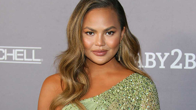 Η Chrissy Teigen δείχνει τις ουλές στο σώμα της!