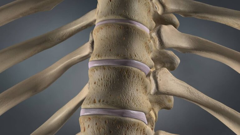 Metropolitan General: Επιτυχημένη διαδερμική κυφοπλαστική σε ασθενή 73 ετών