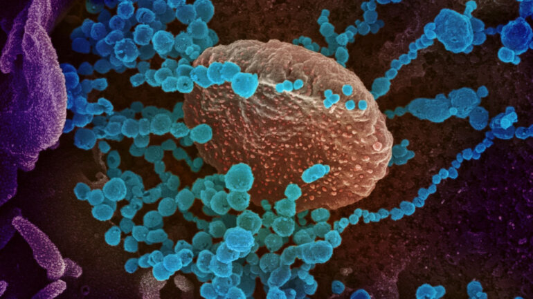 Οι επιστήμονες εντόπισαν πάνω από 140.000 είδη ιών στο ανθρώπινο έντερο