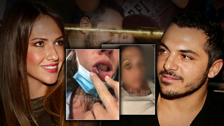 “Με έσπαγε συστηματικά στο ξύλο”