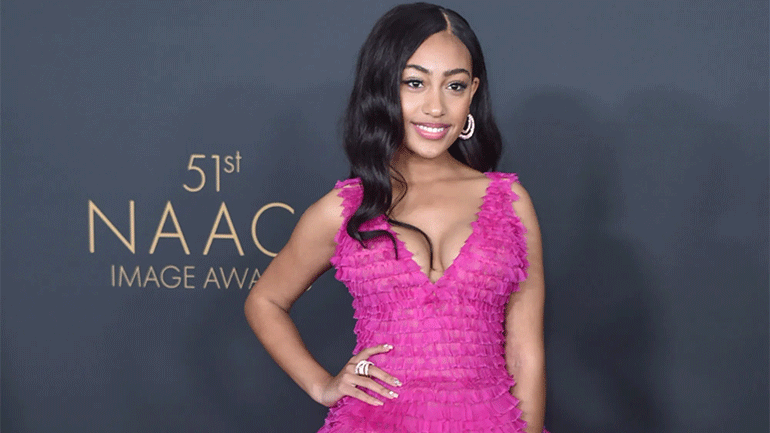 Η Λέξι Άντεργουντ θα εμφανιστεί ως Μάλια Ομπάμα στη σειρά «The First Lady»