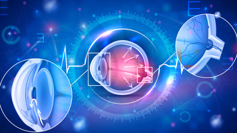 Γλαύκωμα: Όλα όσα πρέπει να γνωρίζετε 