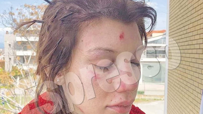 Έξι γυναίκες απήγαγαν, κούρεψαν και ξυλοκόπησαν τη Μαρία Αλεξάνδρου