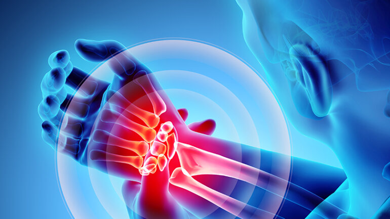 Η συχνή αιτία πόνου στον καρπό που χρειάζεται να ελεγχθεί από ειδικό ορθοπαιδικό 