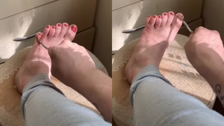 Ένα έξτρα δάχτυλο