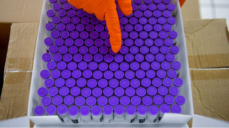 Αυστρία: Ανοιχτά ερωτήματα ως προς την έγκριση του ρωσικού εμβολίου Sputnik-V