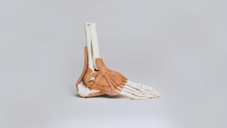 Πόνοι στα οστά: Γιατί δεν πρέπει να τους αγνοούμε; 