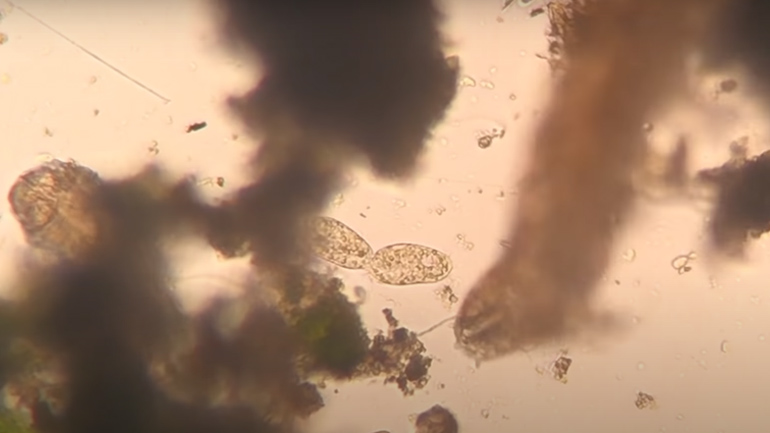 Κυτταρική διαίρεση σε μικροσκόπιο (fail)