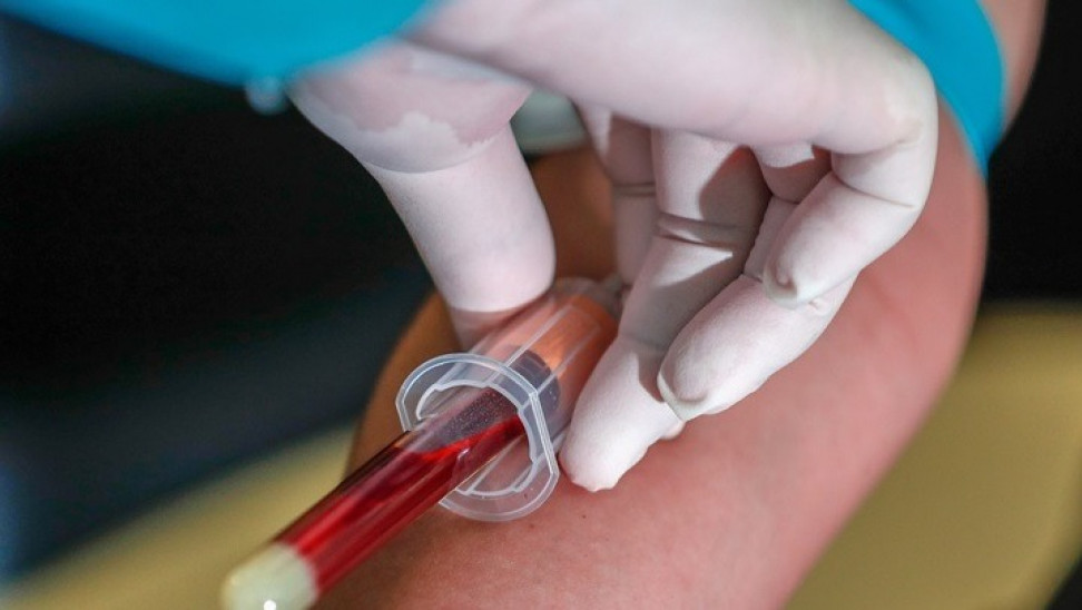 Τα ανοσοκατασταλτικά φάρμακα μπορεί να μειώσουν τα αντισώματα των mRNA εμβολίων Covid-19