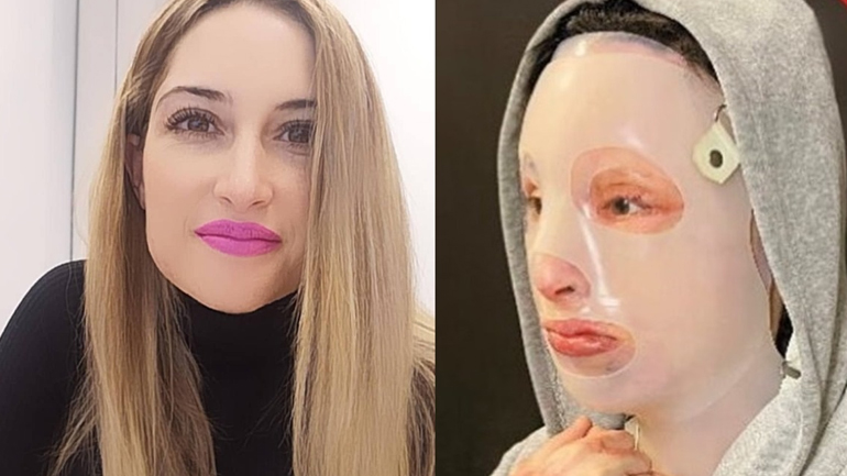 Δικηγόρος Ιωάννας: Δεν μπορεί να βγει στο φως – Λιώσανε οι τοίχοι όπου ακούμπησε το βιτριόλι Δικηγόρος Ιωάννας: Δεν μπορεί να βγει στο φως – Λιώσανε οι τοίχοι όπου ακούμπησε το βιτριόλι