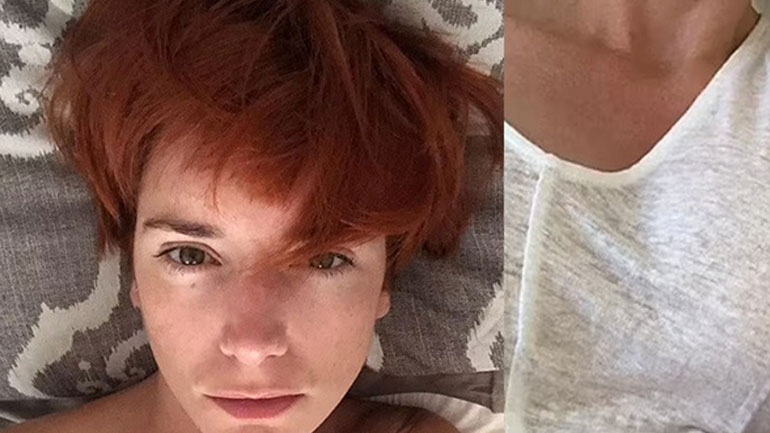 Αυτό είναι το 39χρονο μοντέλο που πέθανε από θρόμβωση στην Κύπρο