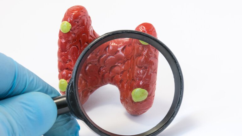 Παθήσεις των παραθυρεοειδών αδένων και χειρουργική αντιμετώπιση