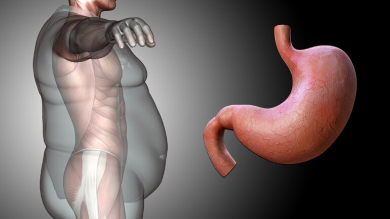 Πώς σχετίζεται η παχυσαρκία με τις παθήσεις του πεπτικού συστήματος