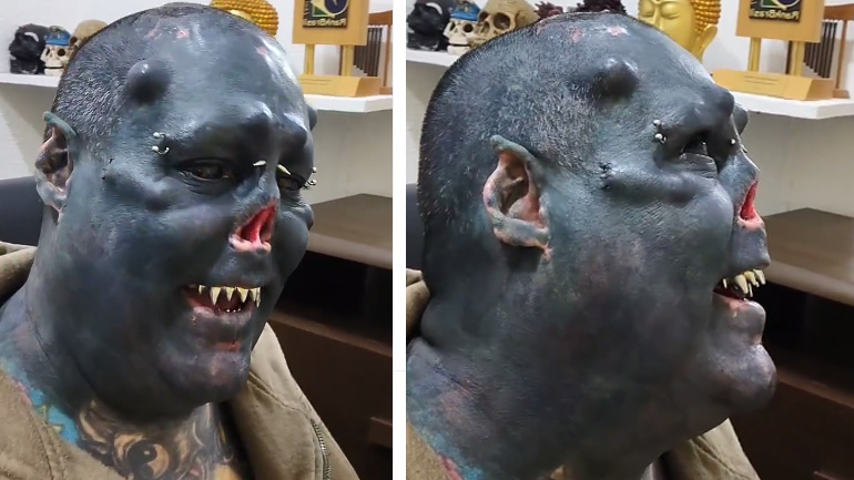 Βραζιλιάνος καλλιτέχνης έκοψε τη μύτη του