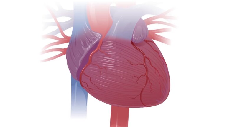 Σχεδόν 1 στους 5 ασθενείς που πεθαίνουν από ανεξήγητο ξαφνικό καρδιακό θάνατο έχουν ύποπτο γονίδιο