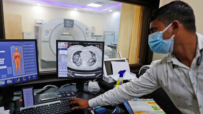 Πόσο πιθανό είναι η COVID-19 να διέφυγε από εργαστήριο: Τι γνωρίζουν οι επιστήμονες