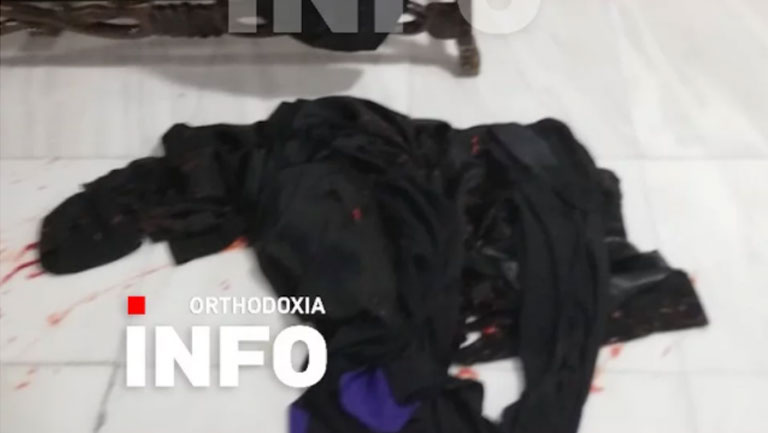 Φωτογραφίες-σοκ από την επίθεση με βιτριόλι