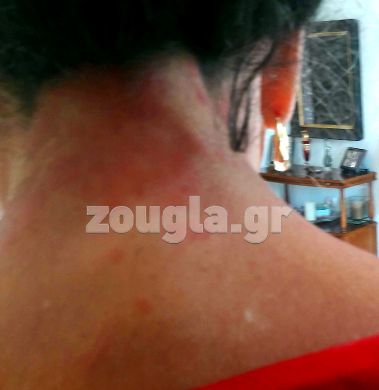 Φωτογραφία με τα συμπτώματα