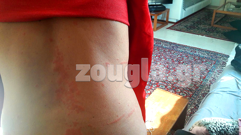 Φωτογραφία με τα συμπτώματα