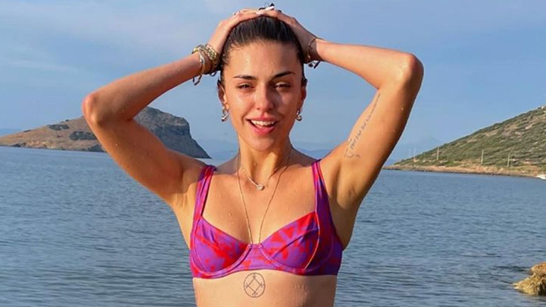 Η Κάτια Ταραμπάνκο μιλάει για τη μάχη της με τη ψωρίαση: «Έχασα δουλειές γιατί…»