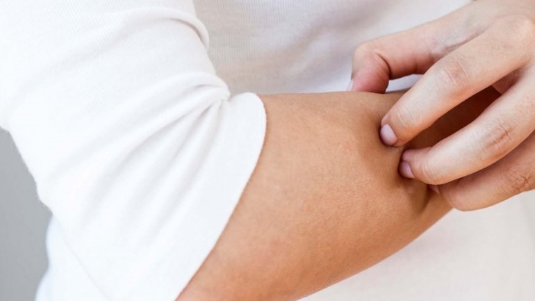 Έγκριση της τραλοκινουμάμπης από την ΕΕ για ενήλικες με μέτρια έως σοβαρή ατοπική δερματίτιδα 